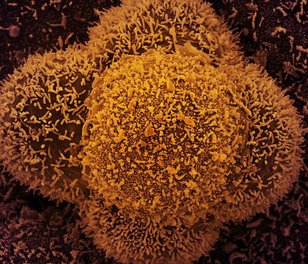 small spherical structures in the center of the image are SARS-CoV-2 virus particles. The string-like protrusions extending from the cells are cell projections or pseudopodium.