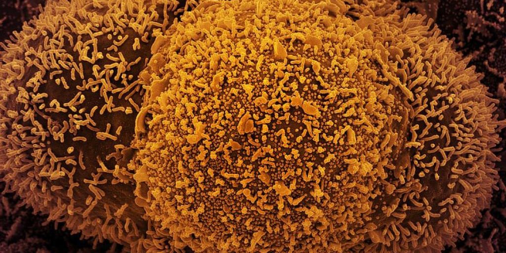 small spherical structures in the center of the image are SARS-CoV-2 virus particles. The string-like protrusions extending from the cells are cell projections or pseudopodium.